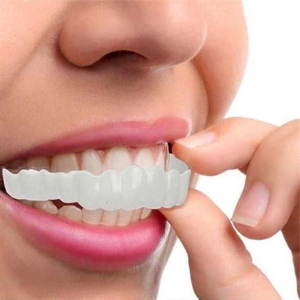 Cosmetic dental veneers positioned to snap onto front teeth