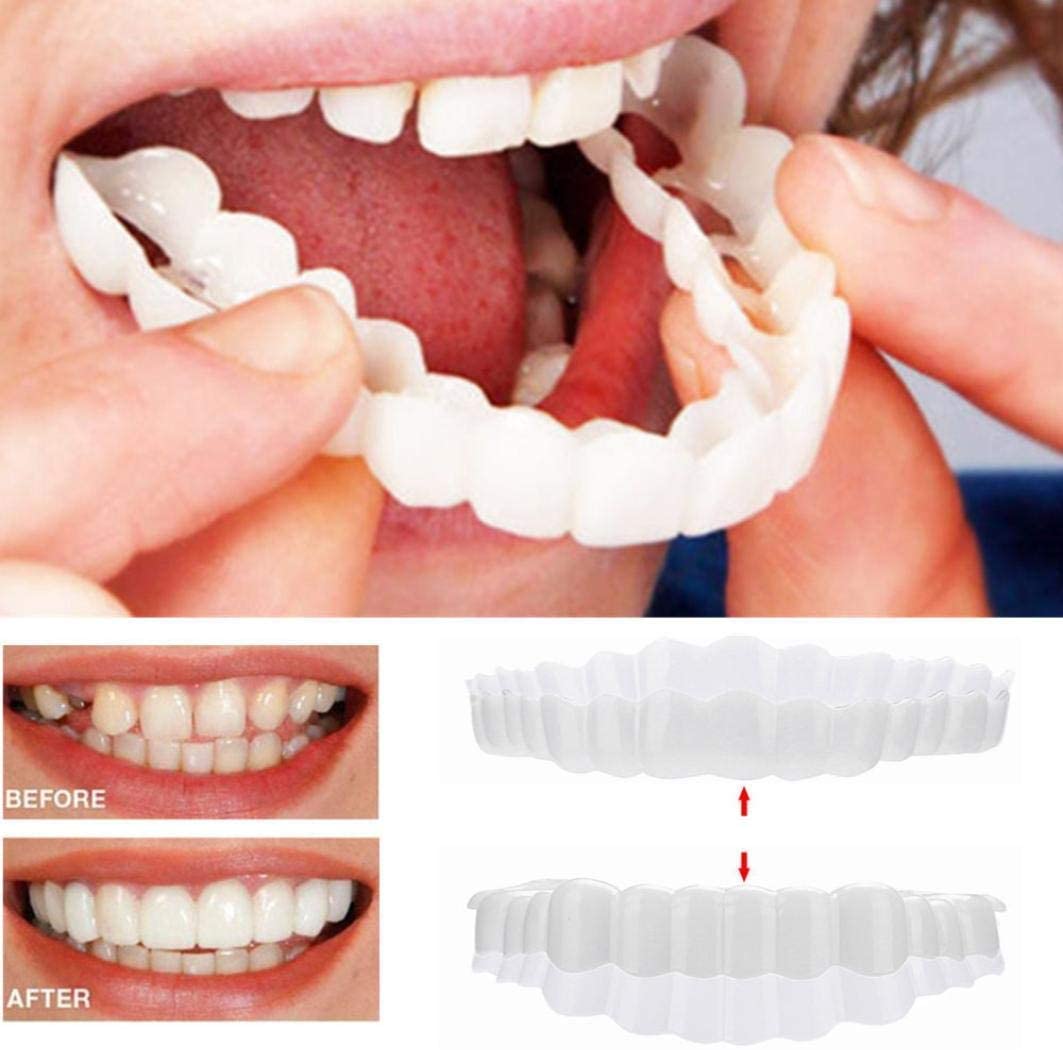 Cosmetic dental veneers shown near mouth with before and after smiles