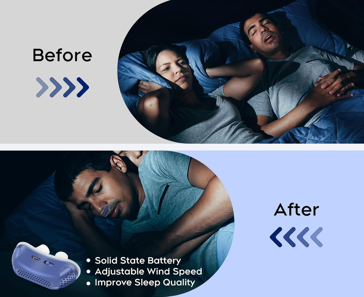 Portable anti-snoring device with nasal cup, shown for sleep improvement