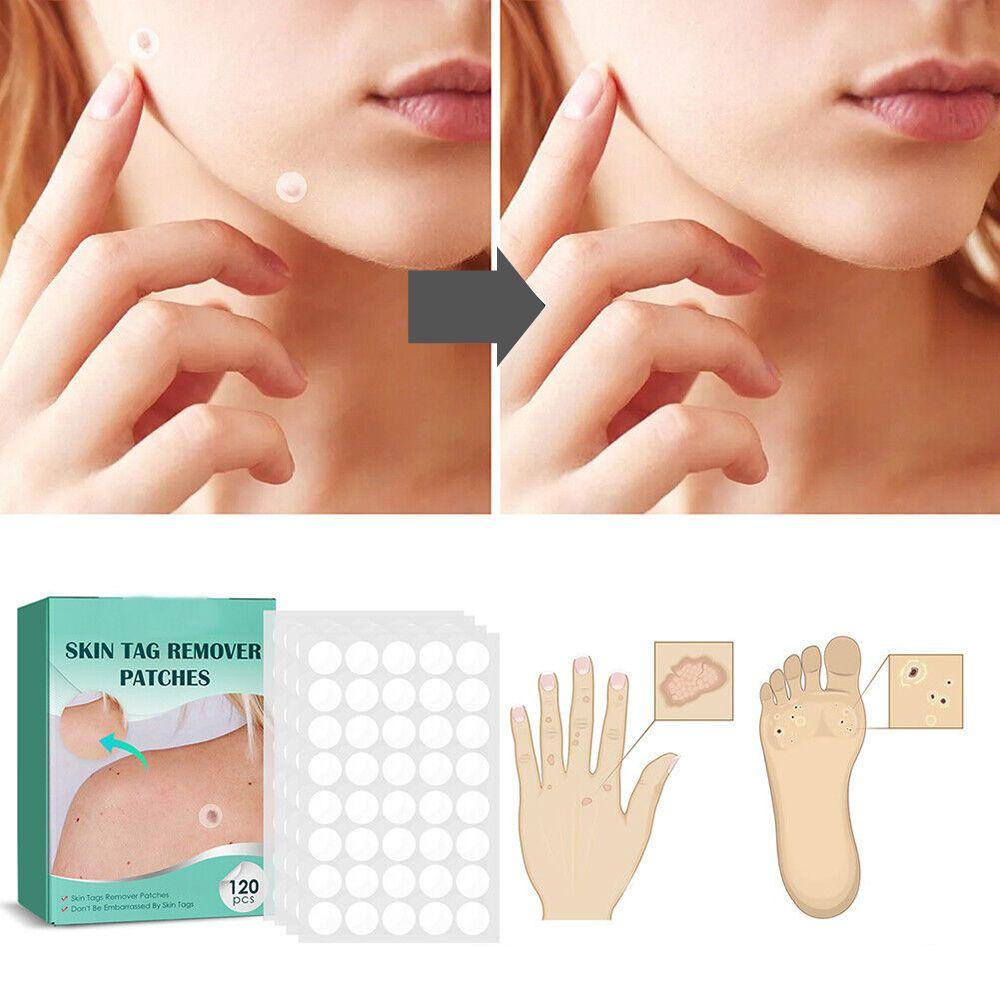 Hydrocolloid Skin Spot Patches 120-Pack