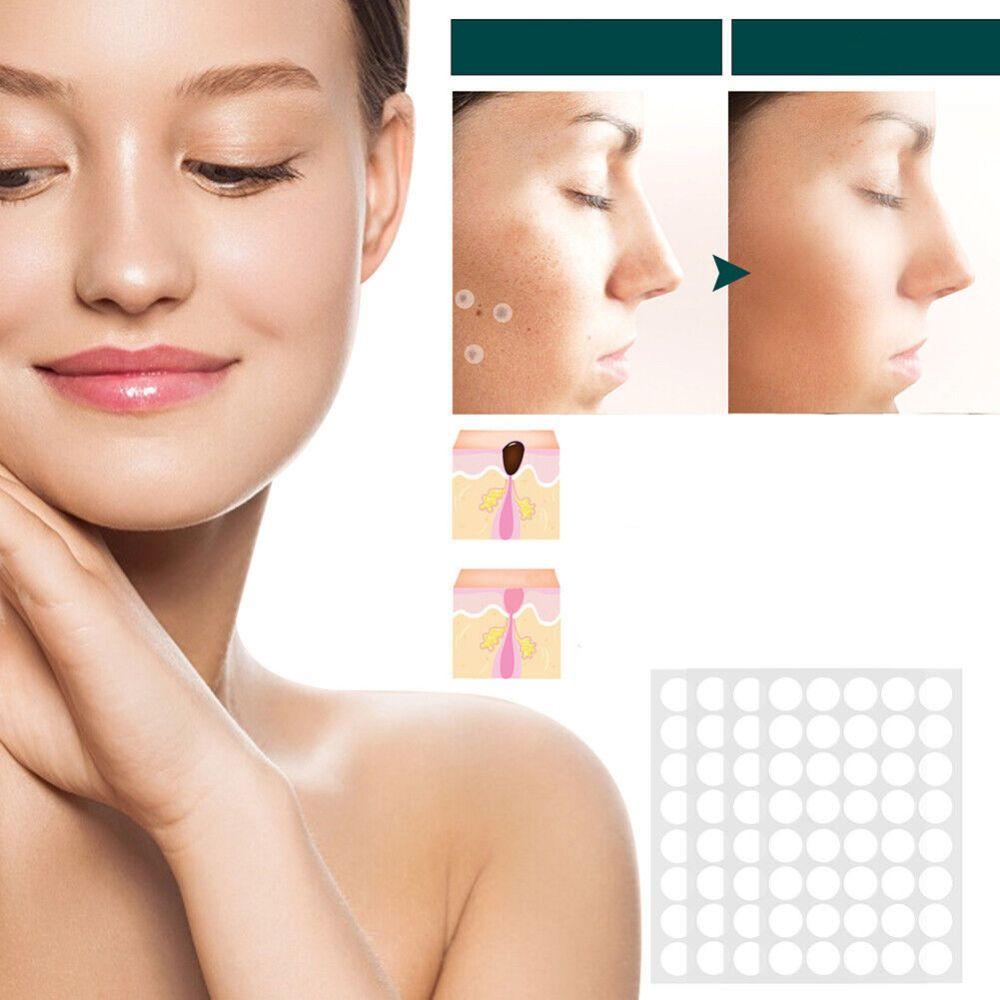 Hydrocolloid Skin Spot Patches 120-Pack