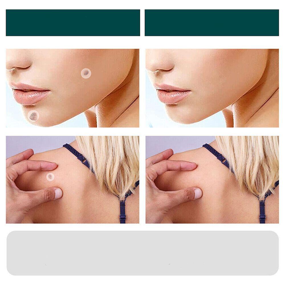 Hydrocolloid Skin Spot Patches 120-Pack