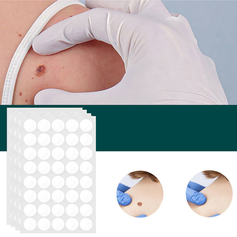 Hydrocolloid Skin Spot Patches 120-Pack