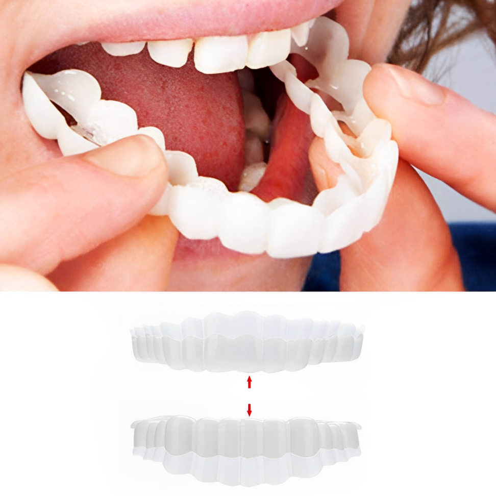Cosmetic dental veneers held over teeth, clear white snap-on fit