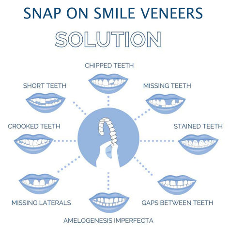 Cosmetic snap-on smile veneers infographic showing teeth issues