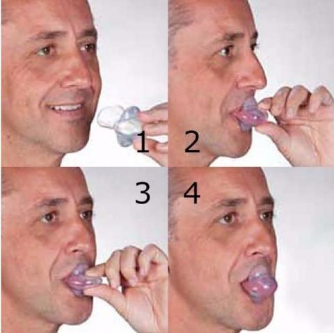 Transparent tongue stabilizing mouthpiece being placed in man’s mouth, four steps